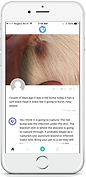 TapVet dog ear problem post