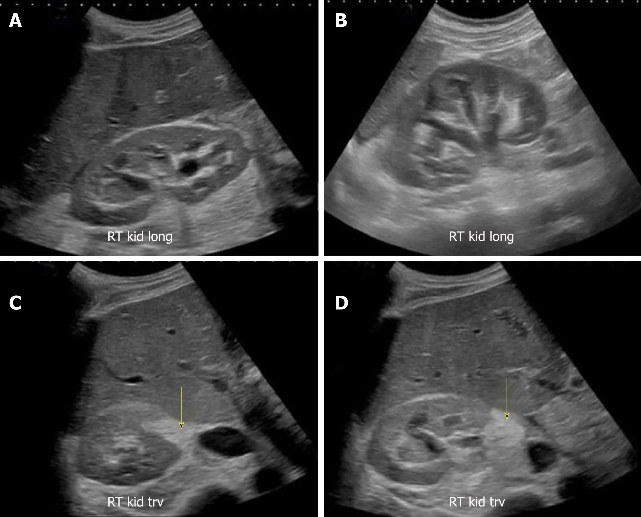 heart sonogram heart sonogram