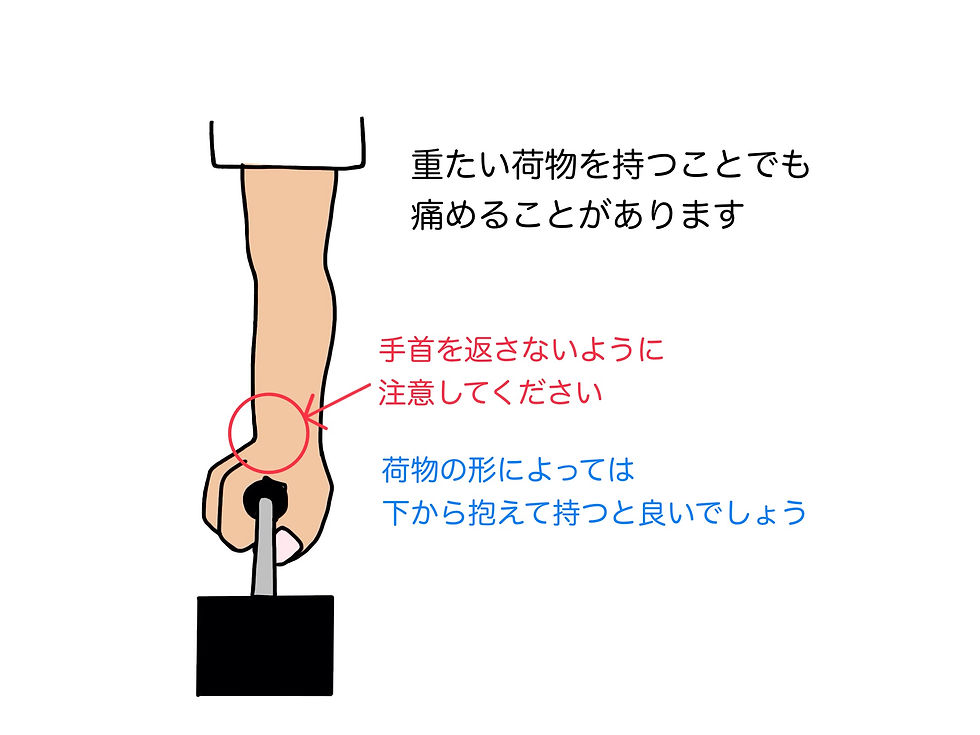 荷物を持つ時に手首を返すと肘への負担が増える