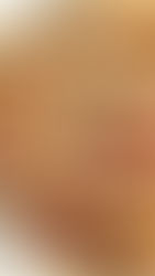 דאמפלינגס קריספיים פתוחים