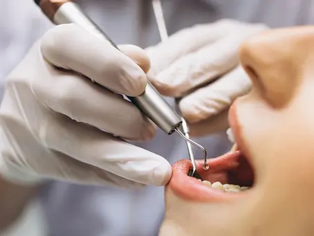 Qualquer Pessoa Pode Fazer Implantes Dentários? A Importância da Avaliação Médica