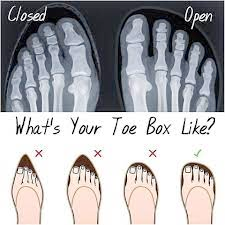 Are Your Feet Sore Because of Narrow Shoes?