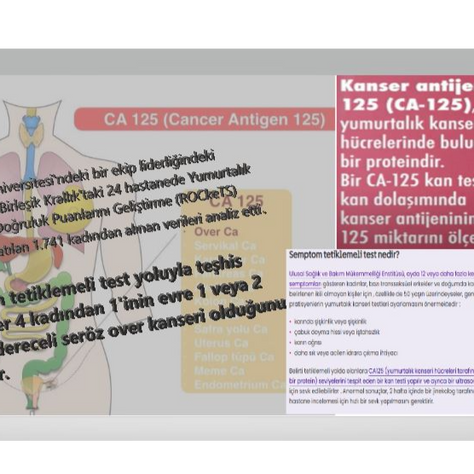 Belirti tetiklemeli testler, doktorların yumurtalık kanserini erken teşhis etmesine yardımcı oluyor