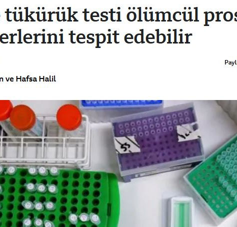 Evde tükürük testi ,ölümcül prostat kanserlerini yakalayabilir !