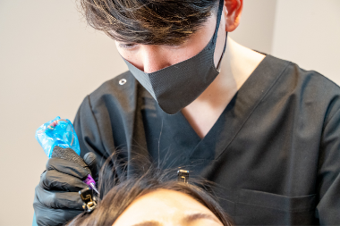 頭皮アートメイク施術