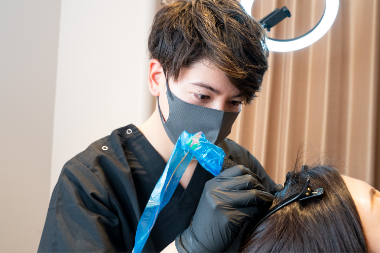 頭皮アートメイク施術画像