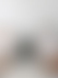 Rejuvenating Health: The Benefits and Potential Side Effects of NAD+ IV Infusions