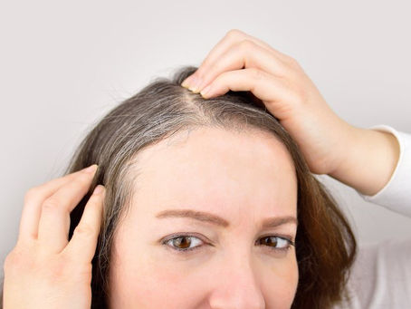 Essential Vitamins and Minerals to Lift Hair Development