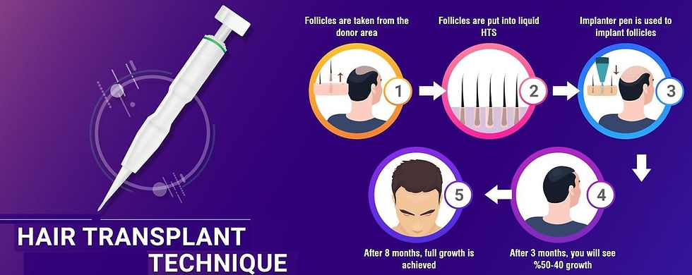 hair transplant in Kolkata
