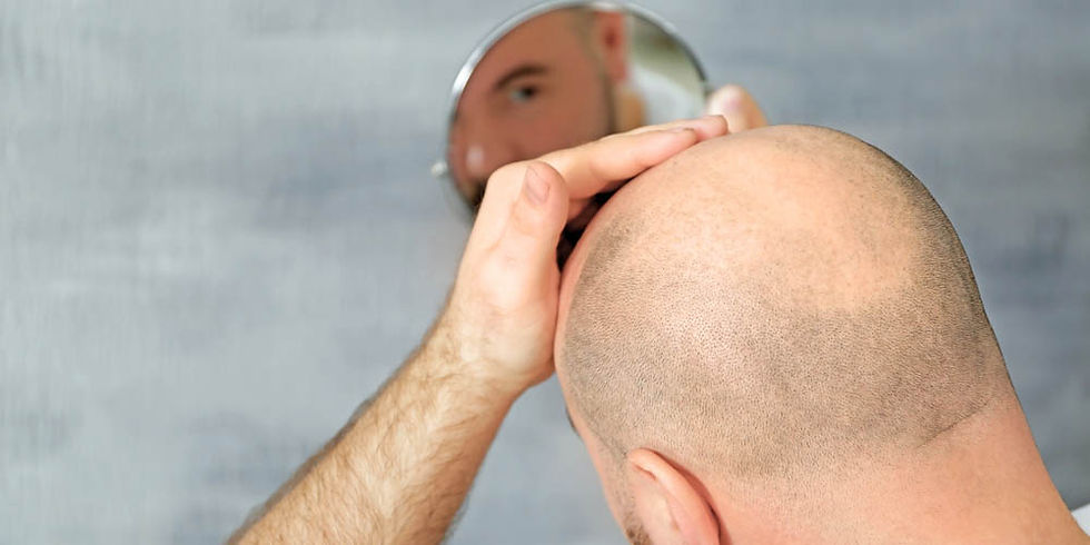 hair loss