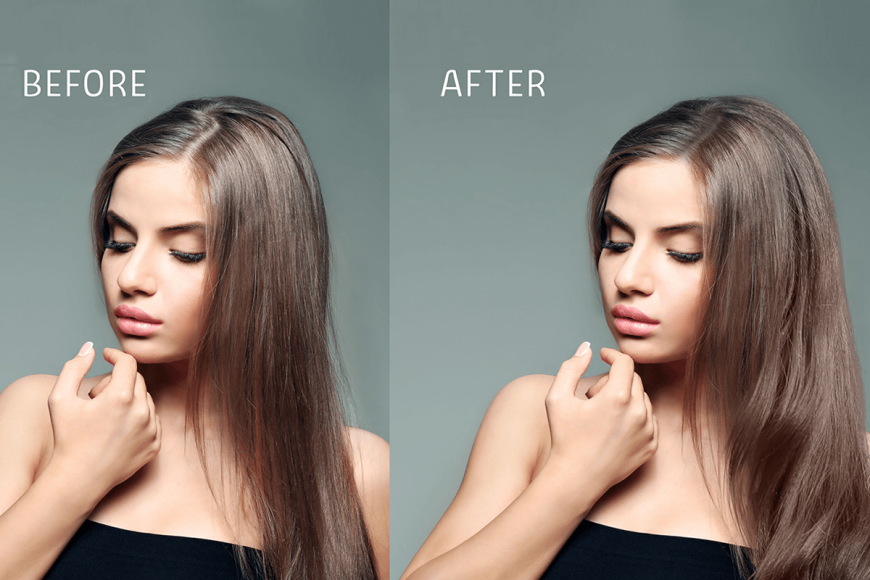 best hair transplant clinic in Kolkata