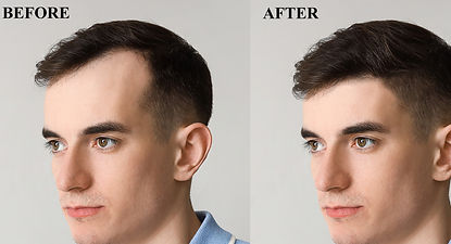 before and after using DuraStem to stop hair loss and see new hair growth