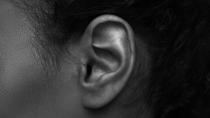 Oreilles décollées autoplastie à reims