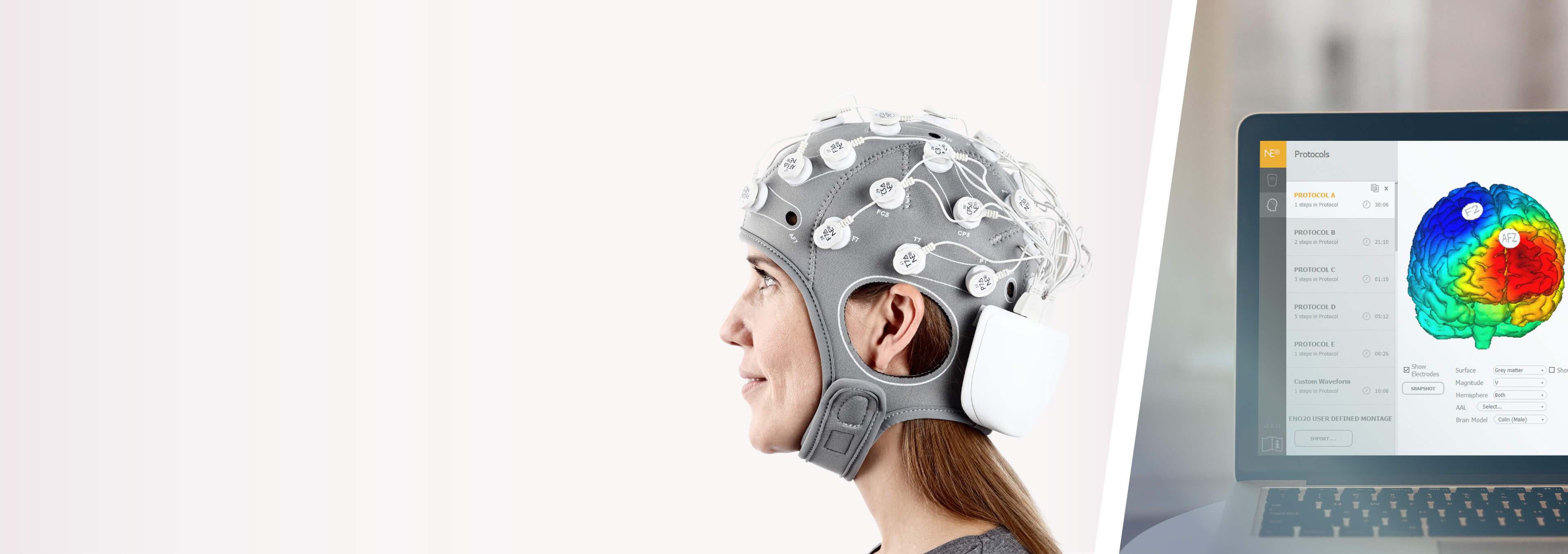 Neuroelectrics