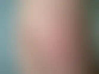 TAVUK DERİSİ CİLT SORUNU