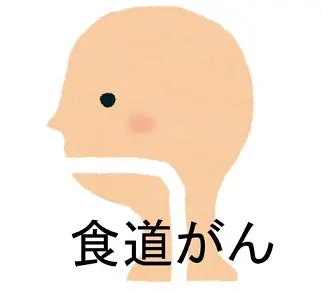 食道がん局所治療薬として厚労省から製造販売承認