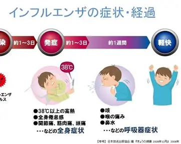 インフルエンザ、全国で流行入り　過去２０年で２番目の早さ