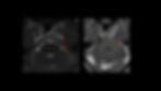 trig mri