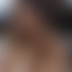 Edelsteine bei Heuschnupfen