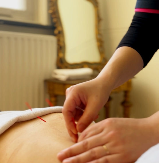 Close-up of a gentle abdominal acupuncture session for chronic bloating and gut imbalance.   Close-up van een zachte buikacupunctuursessie voor chronische een opgeblazen gevoel en darm