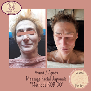 230110_MALOU AVANT APRES KOBIDO insta.png