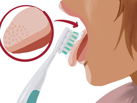 The Case of the White Tongue