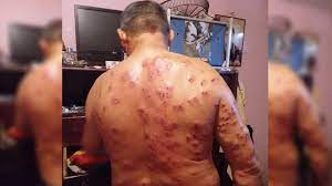 Un Ganadero de Villanueva fue herido con perdigones cuando buscaba por el río Cesar unas vacas