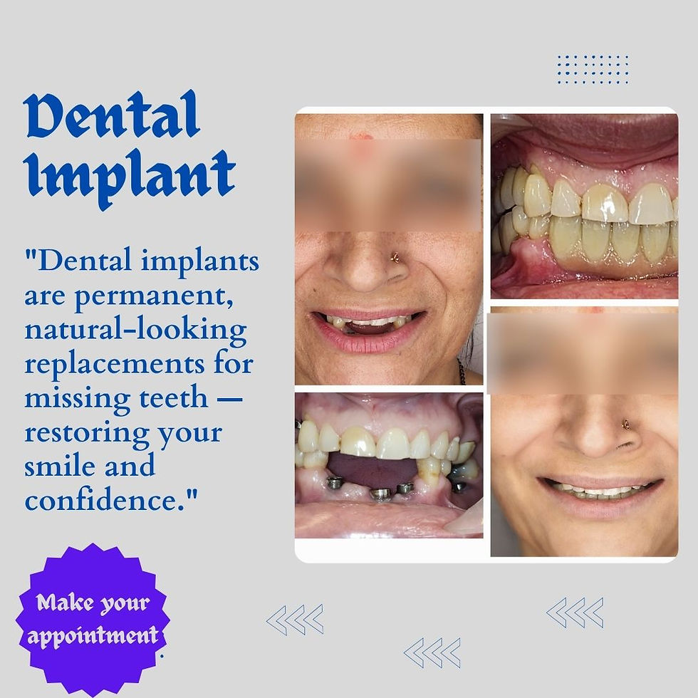 best implant dentist in delhi