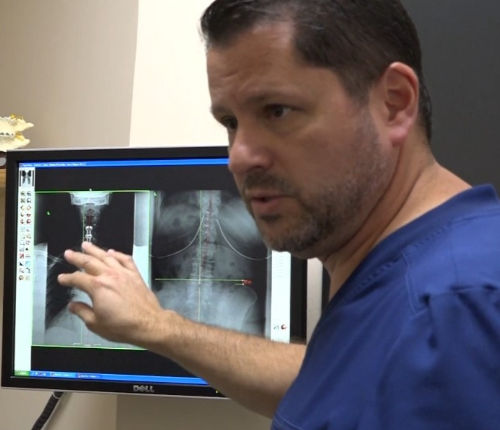 Dr. Gary Hagner providing chiropractic care Xray consultation for a patient at Balanced Body Chiropractic, St Peters, MO