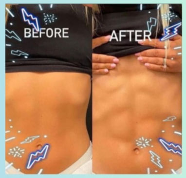 before and after weight loss body sculpting