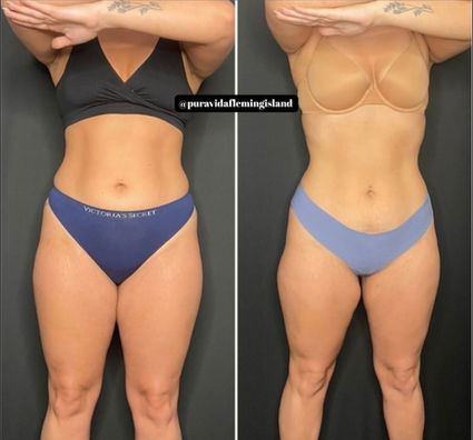before and after weight loss