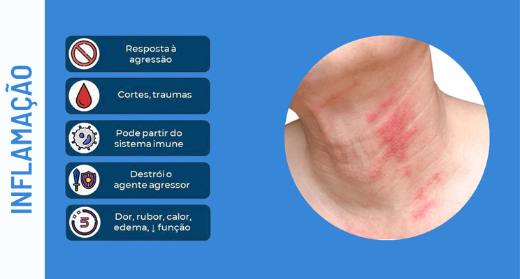 Inflamação vs infeção - o que é uma inflamação?