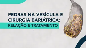 Pedras na Vesícula e Cirurgia Bariátrica: relação e tratamento