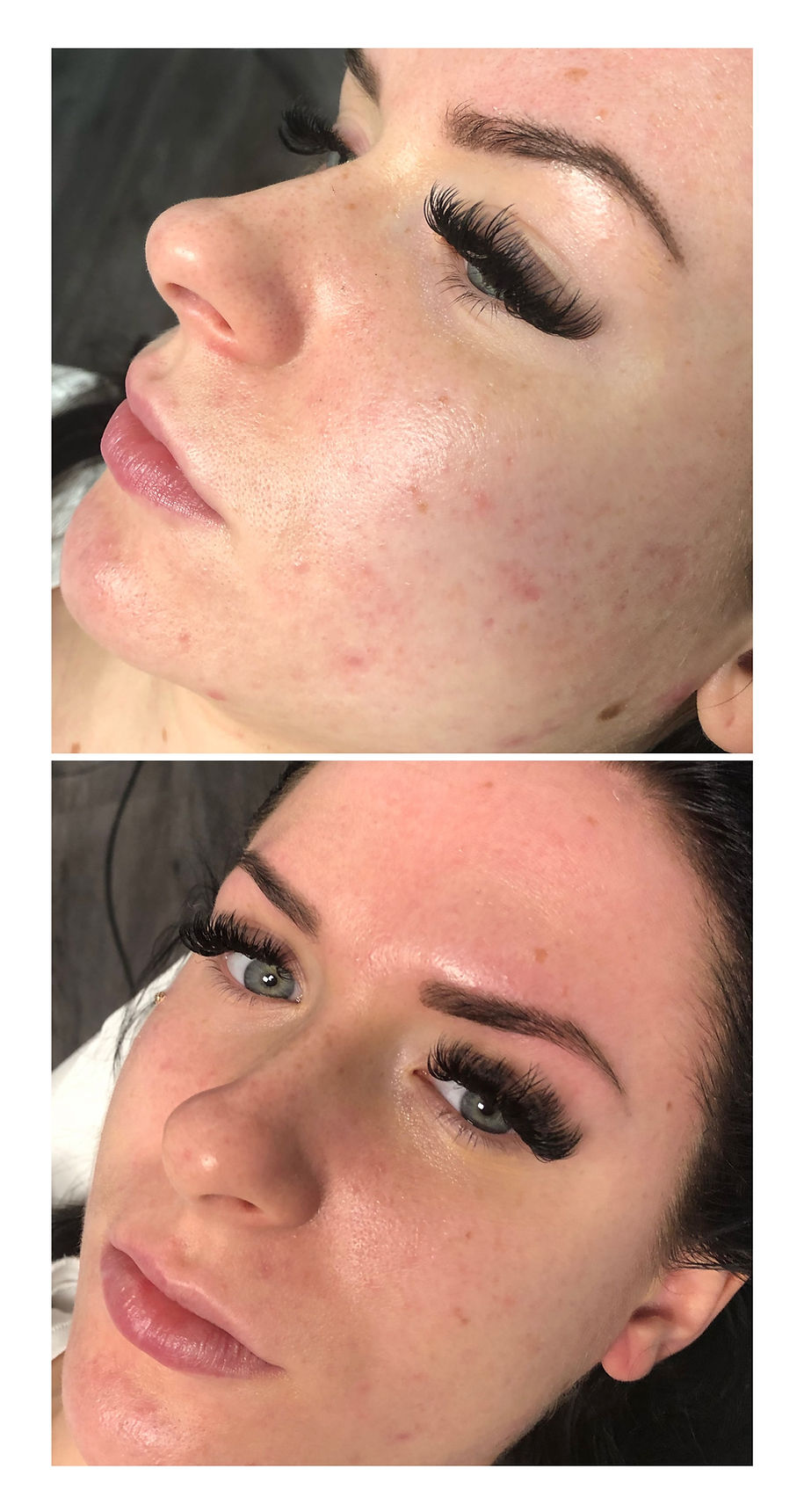 Beautystudio, HydroFacel, Cellulitesbehandlung, 3D HIFU, Permanent Make-Up, Microblading, BB Glow, Lashes, Wimpernverlängerung, Wimperverdichtung, Microneedling, Zahnbleaching, Plasma Pen, Microhaar Pigmentierung, Schulungen, Kosmetikinstitut, Hamburg