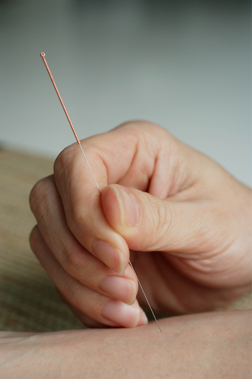 Accupuncture.png