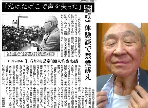 %E5%B2%A1%E5%B4%8E%E6%B2%BB%E5%BD%8C%E3%