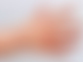 #GraphosCc #Tlx #Noticias | Gobierno Municipal de Zacatelco anuncia medidas preventivas contra el virus Coxsackie en niñas y niños.