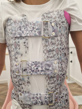 Ortotese Boston| Colete 3D