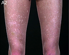 Photo of skin abnormalities