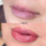 18208581451142777