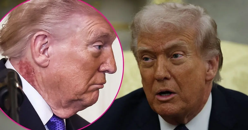 R U 4 Steinmann? Then U R 4 Trump.