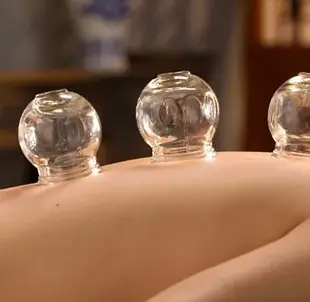 cupping-768x383-1.jpg.webp