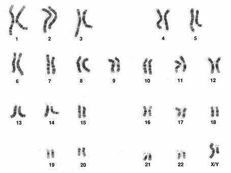 DNA-Familienforschung (Teil 4)