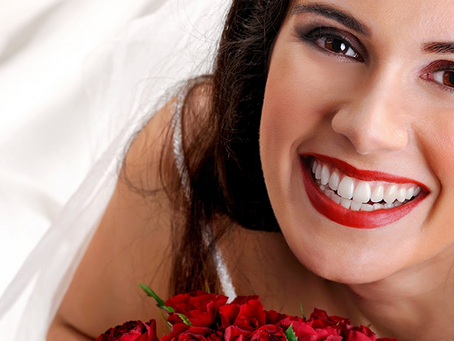 Noivas modernas fazem clareamento dental para o grande dia.