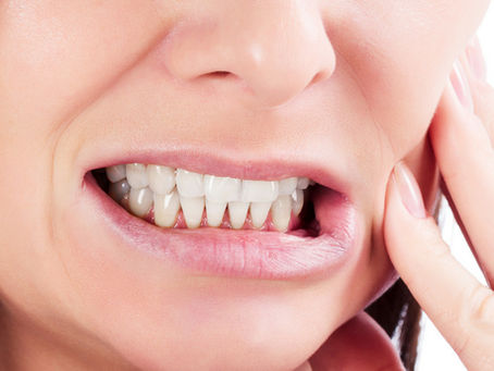 O bruxismo é o hábito de ranger/apertar os dentes.