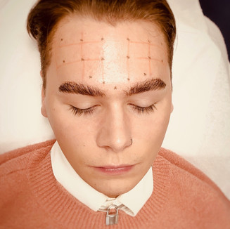 Mirror Aesthetic Anti-Wrinkle Injections