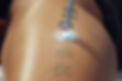 tattoo removal harlow.jpg