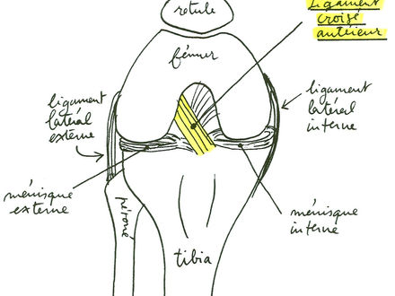Rupture du ligament croisé du genou