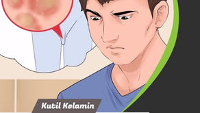Penyebab Dan Pengobatan Kutil Kelamin