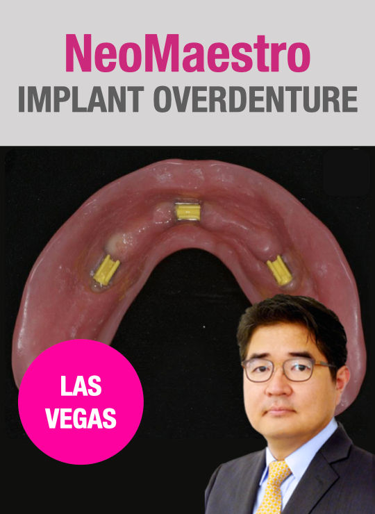 Oct. 10, 2021 Implant Over-denture